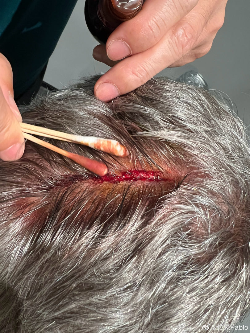 蒂恩意外受 蒂恩意外受